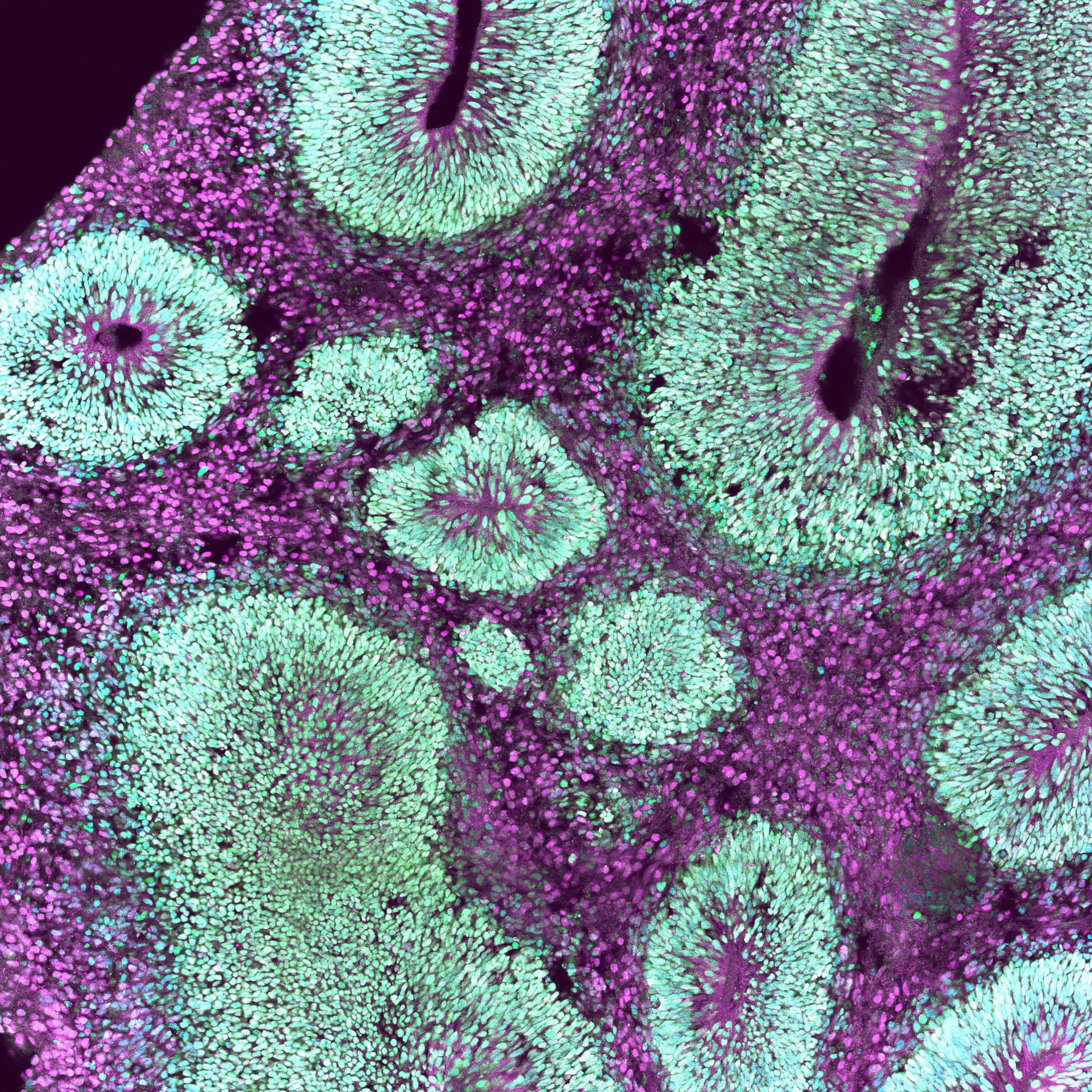 Purple and green dots from a stained section of cultured brain organoid tissue. The dots are nuclei of each cell arranged in circular groups.